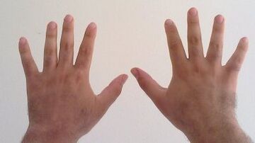 Archivo:Two hand, ten fingers