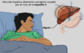 A young boy suffering from Hepatitis-A-es
