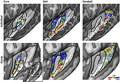 Archivo:Working model of human auditory cortex Fnins-08-00225-g005