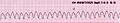 Lead II rhythm ventricular tachycardia Vtach VT