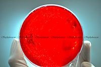 Archivo:Staphylococcus aureus on agar