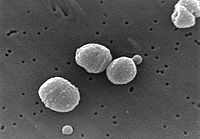 Archivo:Streptococcus pneumoniae