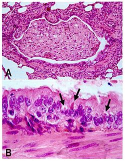 Canine distemper pathology.jpg