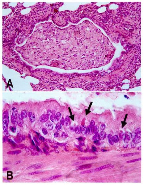 Canine distemper pathology