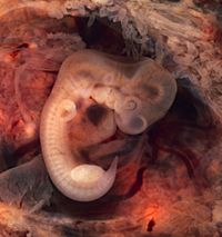 Archivo:Tubal Pregnancy with embryo