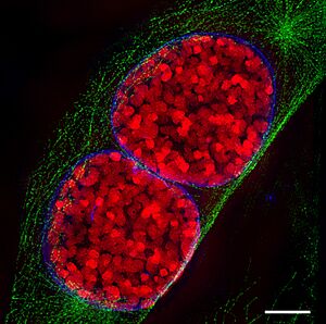 Archivo:3D-SIM-3 Prophase 3 color