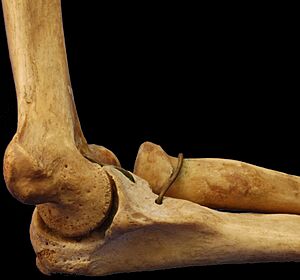 Archivo:MedialHumerusRadiusUlnaArticulated