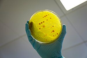 Archivo:Antimicrobial resistance