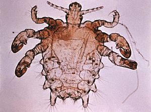 Archivo:Pthirus pubis - crab louse