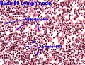 Reticular Cells
