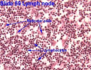 Archivo:Reticular Cells