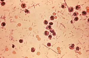Archivo:Shigella stool
