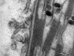 Archivo:Chloroplast in leaf of Anemone sp TEM 85000x