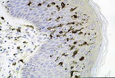 Dendritic cells.jpg