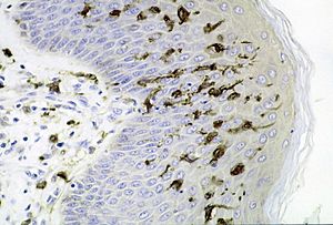 Dendritic cells.jpg