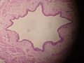 Ureter