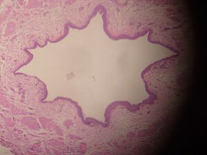 Archivo:Ureter