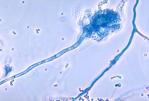 Archivo:Aspergillus fumigatus 01