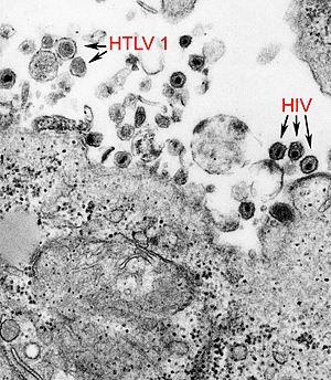 Archivo:HTLV-1 and HIV-1 EM 8241 lores