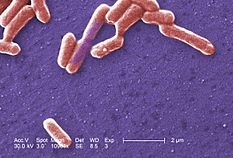 Escherichia coli (bacteria)