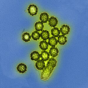 Archivo:H1N1 Influenza Virus Particles (8411599236)