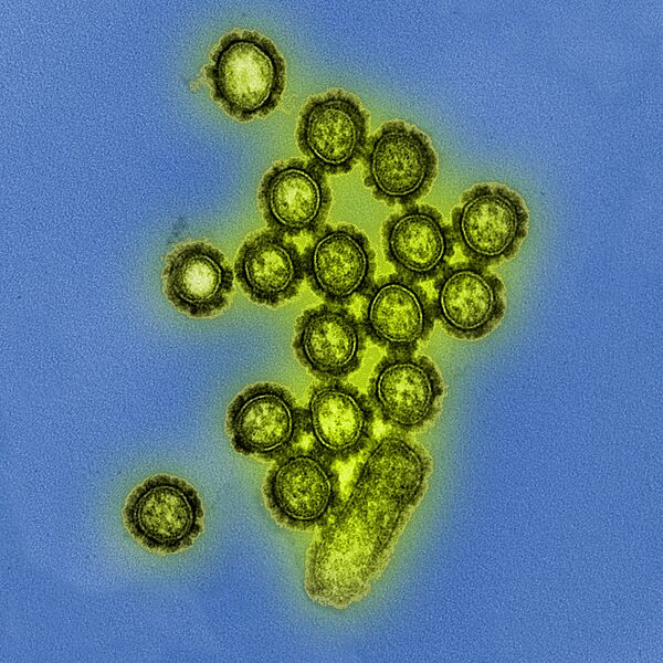 H1N1 Influenza Virus Particles (8411599236)