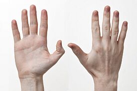 Archivo:Human-Hands-Front-Back