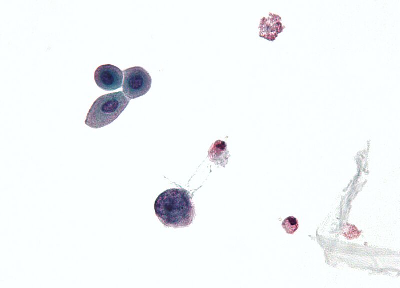 Polyomavirus