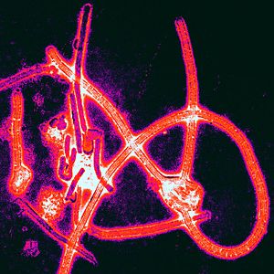 Archivo:Ebola virus particles