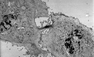 Archivo:Cytokinesis-electron-micrograph