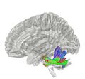 Middle Cerebellar Peduncle
