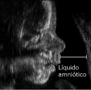 Archivo:Liquido amniotico