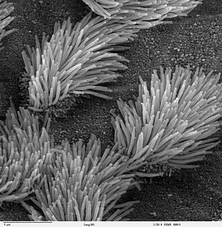 Bronchiolar epithelium 3 - SEM.jpg