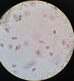 Archivo:Chromatium Okenii al microscopio