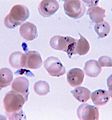 Plasmodium