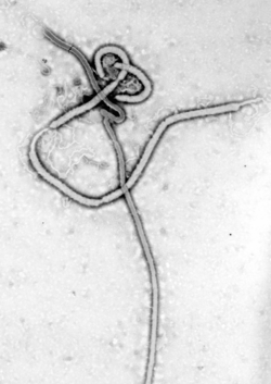 Archivo:Ebola virus em