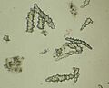 Spicules