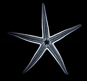 Archivo:Starfish Roentgen X-Ray 01 Nevit