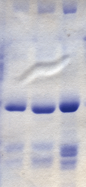 Archivo:Coomassie blue stained gel