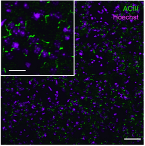 Archivo:Cilia Primaria Cerebro