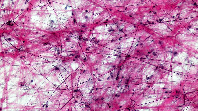 Connective Tissue Loose Aerolar (41743648512)