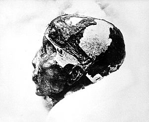 Archivo:Tutankhamun's mummified head