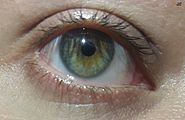 Eye with central heterochromia (green and brown)