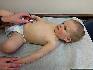 Archivo:Physical examination of child, age 15 months
