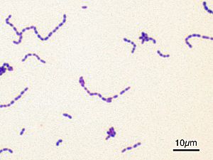 Archivo:Streptococcus mutans Gram