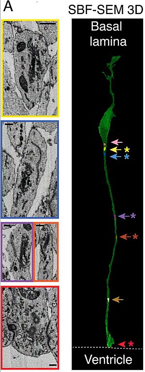 Archivo:Golgi ubicacion Glia-radial Rata