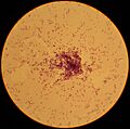 Lactococcus lactis