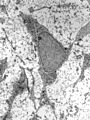 MSC high magnification