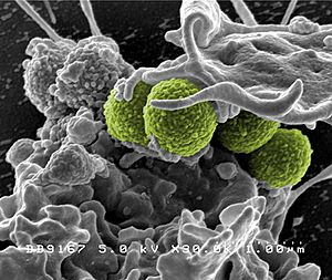 Archivo:Hospital-associated Methicillin-resistant Staphylococcus aureus (MRSA) Bacteria