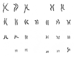 Archivo:NHGRI human male karyotype